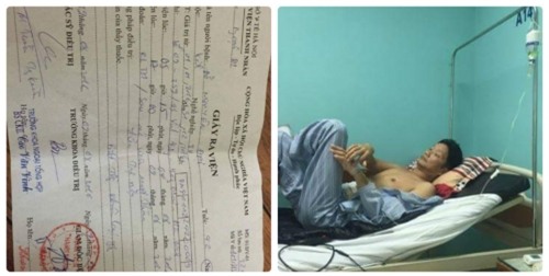 chuyen gia 'mo xe' vu ung thu dai trang lai mo ruot thua - 1