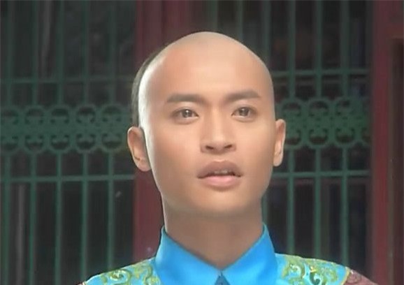 Chàng Nhĩ Thái của Hoàn Châu Cách Cách mặt cứng đờ, già xọm vì phẫu thuật thẩm mỹ - Ảnh 9.