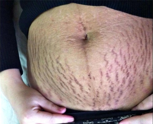 ran trang, ran do tren da se mo dan moi ngay nho hon hop duoi day - 1