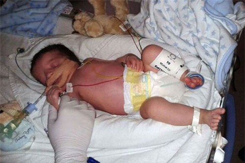 khong sieu am 4d vi muon bat ngo, bo me ‘chet dung’ khi sinh con di dang the nay - 3