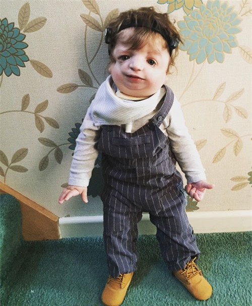 khong sieu am 4d vi muon bat ngo, bo me ‘chet dung’ khi sinh con di dang the nay - 5