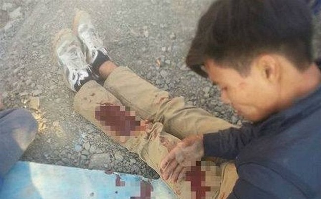 Hà Nội: Quay clip cãi nhau, nam thanh niên bị chém trọng thương