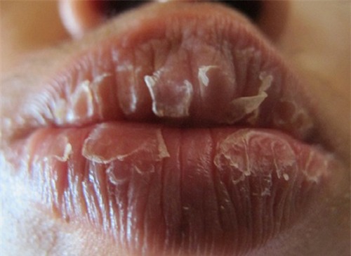 moi kho ne bat mau ngay dong se mem mai ngay sau mot dem sau khi boi hon hop nay - 1