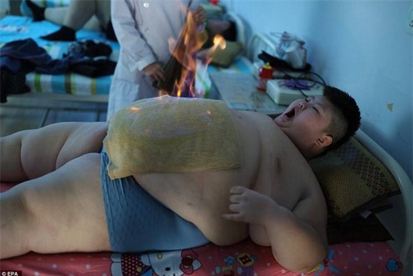 các kiểu đốt cháy mỡ