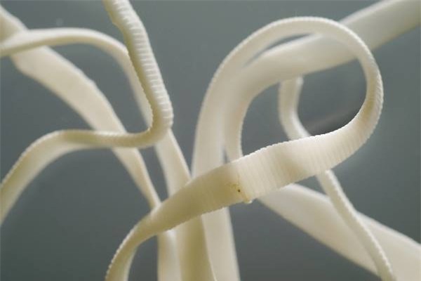 các kiểu đốt cháy mỡ