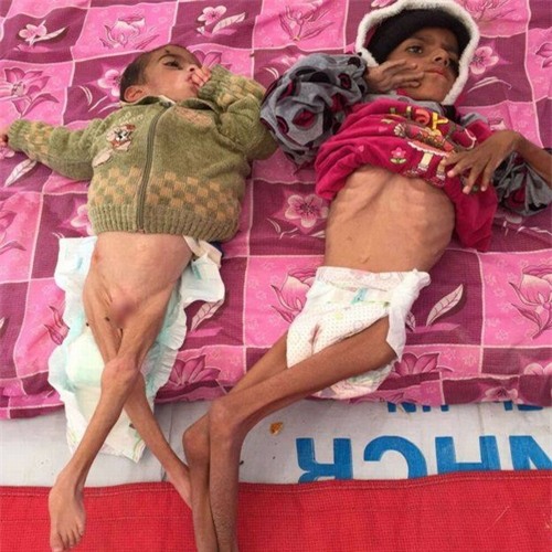 nhin vao nhung buc anh tre em nay ai cung rung minh boi su that tham khoc cua chien tranh - 2