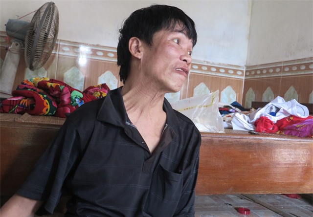 Anh cũng rất khó khăn trong việc nói chuyện, mỗi lần cố gắng muốn nói điều gì đó anh phải rất khó khăn.