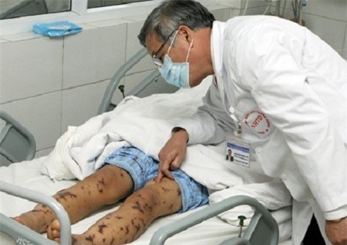 Ha Noi: Nu sinh 18 tuoi hon me vi nhiem nao mo cau hinh anh 1