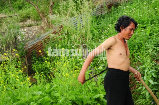 Những may mắn bất ngờ của người đàn ông có đuôi dài nửa mét ở Hà Giang - Ảnh 2.