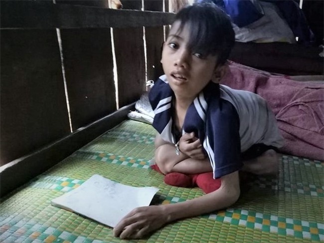 Noi buon cua cau be lung gu 90 do hinh anh 1