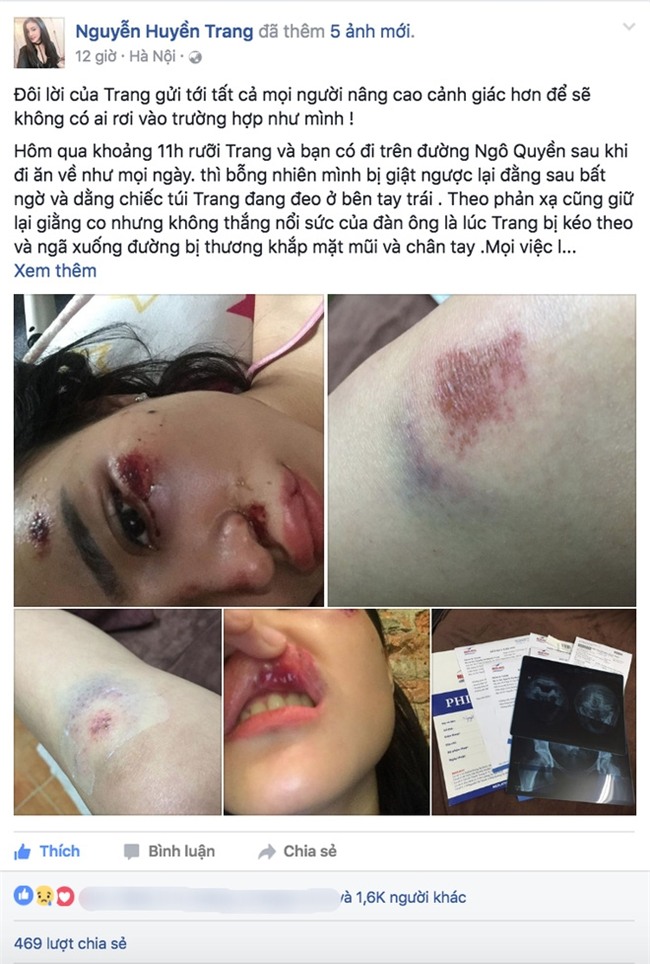 Chân dung cô gái “đau khổ” nhất đêm qua, tiền mất tật mang vì 1 chiếc túi - Ảnh 1.