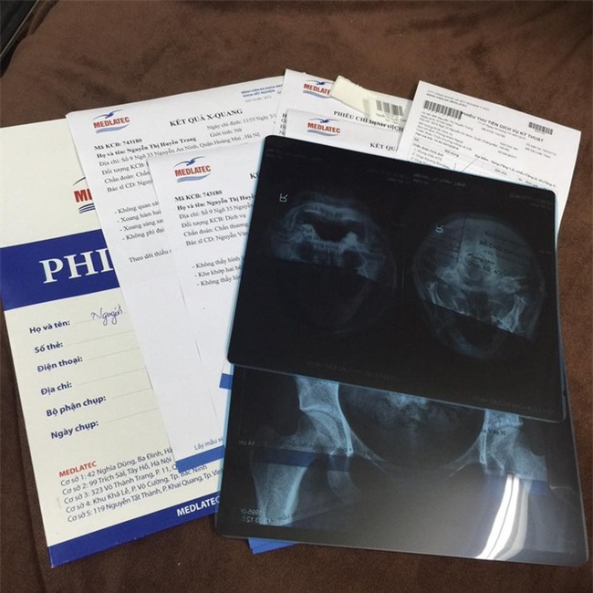 Chân dung cô gái “đau khổ” nhất đêm qua, tiền mất tật mang vì 1 chiếc túi - Ảnh 2.