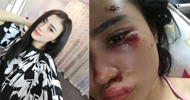 Chân dung cô gái “đau khổ” nhất đêm qua, tiền mất tật mang vì 1 chiếc túi - Ảnh 3.