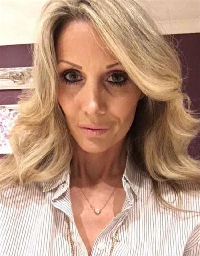 Không chỉ riêng nước mình đâu, bác sĩ thẩm mỹ ở Anh cũng biến lúm đồng tiền thành thảm họa thế này đây - Ảnh 5.