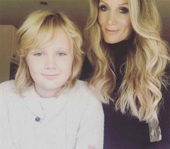 Không chỉ riêng nước mình đâu, bác sĩ thẩm mỹ ở Anh cũng biến lúm đồng tiền thành thảm họa thế này đây - Ảnh 6.