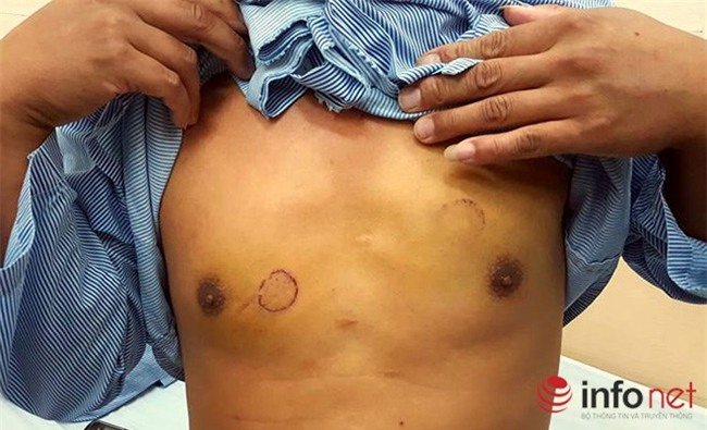 ngoi uong ca phe voi ban gai, nguoi dan ong bi danh chan thuong so nao - 2