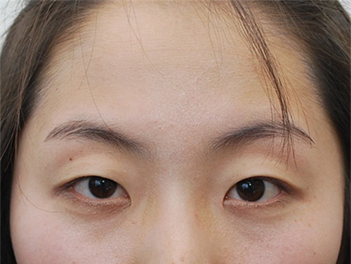 cach lam don gian nhung lai khien long mi dai ram nhu bup be chi trong 1 tuan - 1