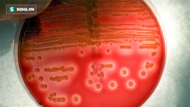 Cô gái ở HN tử vong sau 1 tuần chỉ ho, sốt: BS cảnh báo hiểm họa kinh khủng hơn cả ung thư - Ảnh 3.