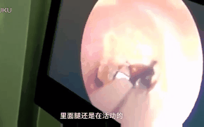 Cứ bầy bừa đồ ăn ở đầu giường đi, cẩn thận có ngày hối không kịp như người phụ nữ này