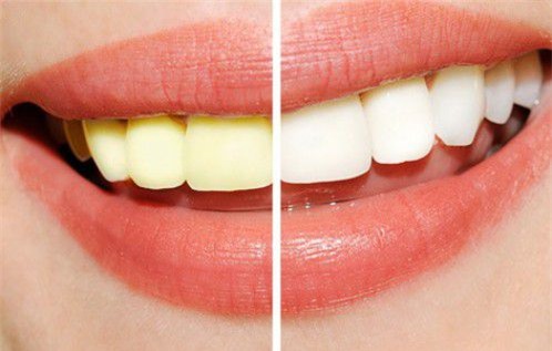 Đừng vứt vỏ chuối đi, vì bạn chưa biết chúng có nhiều công dụng thế nào đâu! - Ảnh 1.