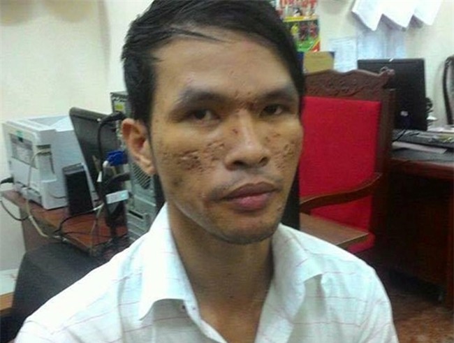 Noi dau cua cha me be trai Campuchia bi hanh ha hinh anh 3