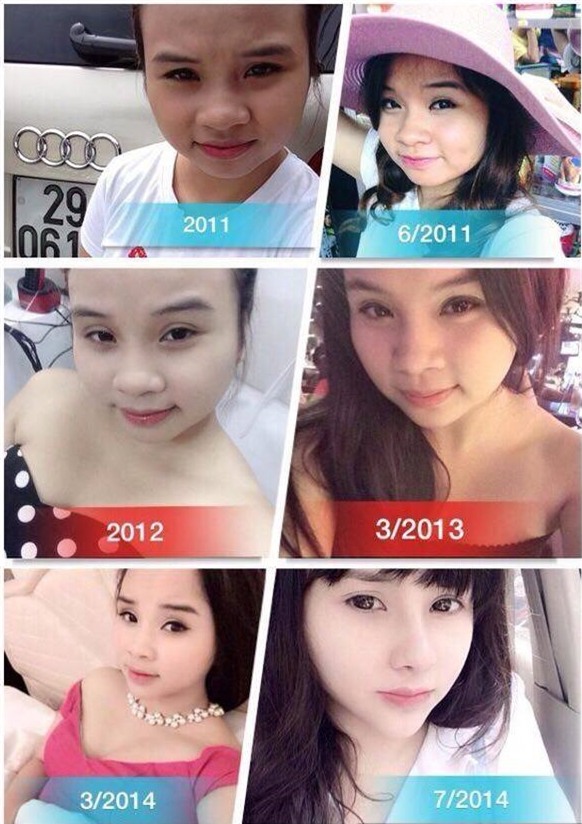 Những cô gái từng nổi đình nổi đám vì đập cả mặt, đập cả người đi xây lại giờ ra sao? - Ảnh 15.