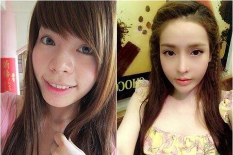 Những cô gái từng nổi đình nổi đám vì đập cả mặt, đập cả người đi xây lại giờ ra sao? - Ảnh 6.