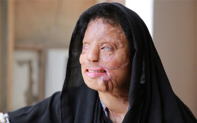 Vượt qua cơn ác mộng bị tạt axit, cô gái trẻ giành 1 tỷ đồng trong Ai là triệu phú - Ảnh 2.