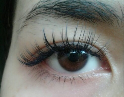 long mi dai, cong va den nhay trong mot tuan nho bo doi vitamin e va vaseline - 5