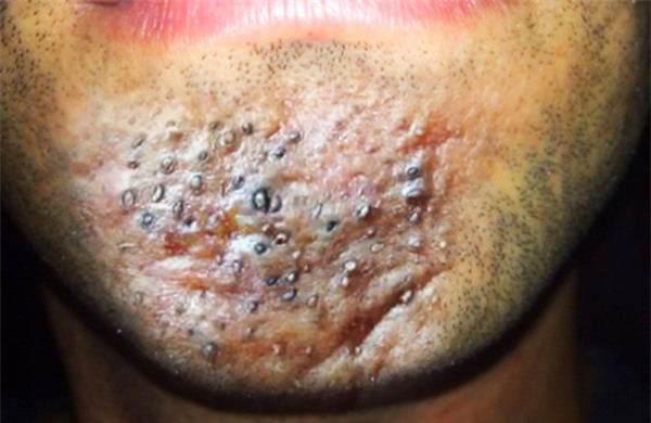 11990960_10205123180504724_711974312_o-a979c