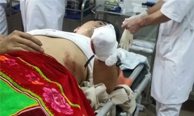 Nam thanh niên tự chặt tay rồi bảo mẹ... nấu cháo