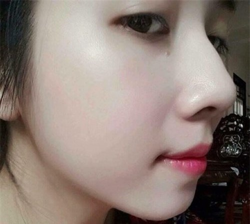 duong da bang mat ong truoc khi ngu va ket qua sau mot dem se khien ban bang hoang - 2