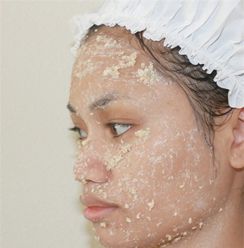 duong da bang mat ong truoc khi ngu va ket qua sau mot dem se khien ban bang hoang - 5