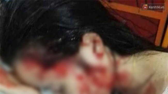 Đang nấu ăn, thiếu nữ bất ngờ bị khống chế, bắt lên taxi rồi dùng dao đâm vào đầu - Ảnh 1.