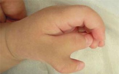 lam mong luc mang thai 3 thang, me dau don khi nhin anh sieu am thai - 3