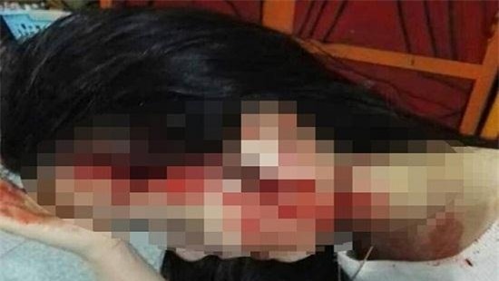 Co gai bi hanh hung tren xe taxi: Co giao cap 2 bi to co tham gia