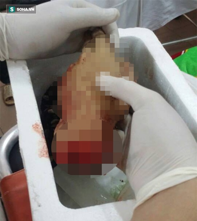 Gia đình, hàng xóm nói gì về nam thanh niên tự chặt tay mình? - Ảnh 2.