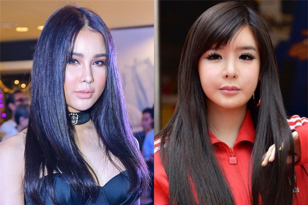 diệp lâm anh thẩm mỹ