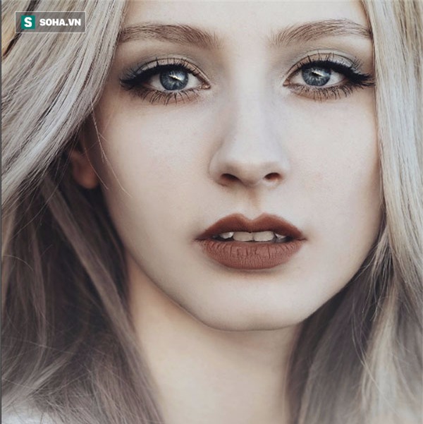 Cảnh báo: Người có dấu hiệu này ở mắt có thể sắp đột quỵ - Ảnh 1.