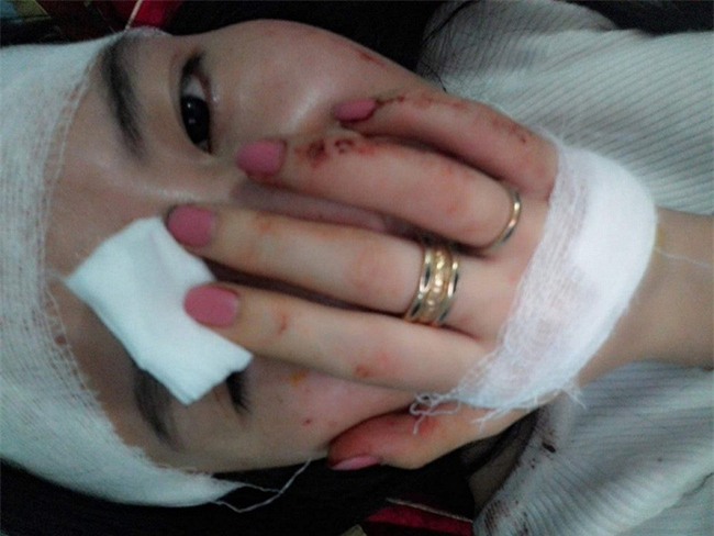 Thiếu nữ tố bị cô giáo bắt cóc, hành hung dã man trên taxi: Triệu tập 3 đối tượng - Ảnh 1.