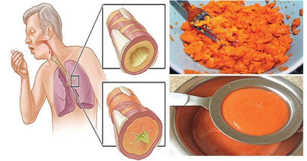 Nói không với kháng sinh, chỉ dùng bài thuốc cổ đại uống 2 ngày là hết hẳn đờm, ho - Ảnh 1.