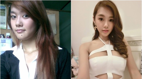 Chân dài Linh Chi là một trong những người đẹp đầu tiên thừa nhận phẫu thuật nâng ngực. Tuy nhiên, khi được hỏi về việc liệu cô có chỉnh sửa gì trên khuôn mặt không thì chân dài