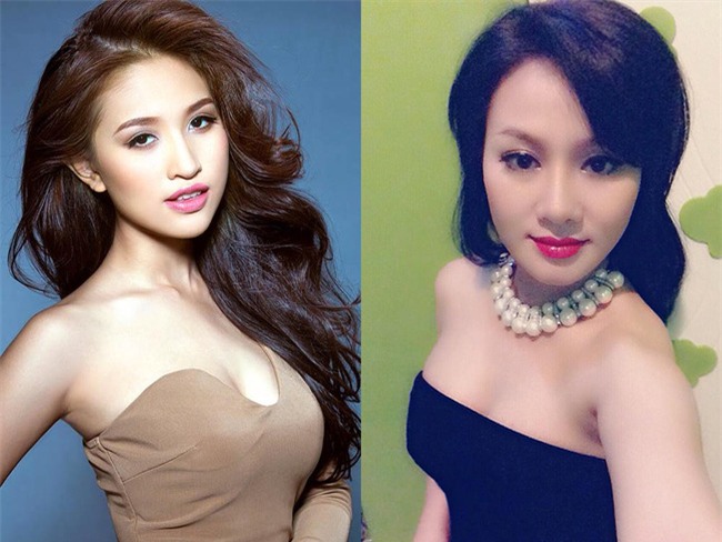 Xơ dây thanh quản - căn bệnh có thể Thanh Vân Hugo và ca sĩ Thu Phượng bị câm nguy hiểm thế nào? - Ảnh 1.