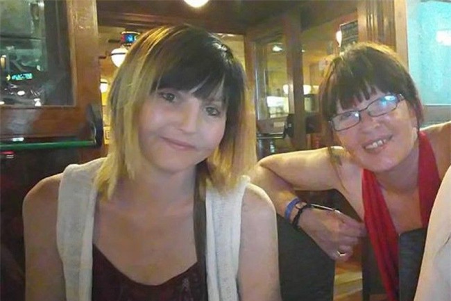 Làm điều này khi đi giày cao gót, người phụ nữ đã phải cắt cụt một chân - Ảnh 1.