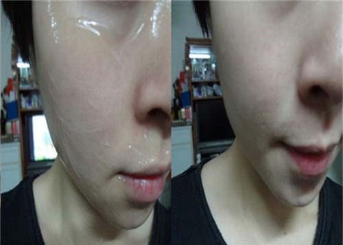 khong can tam trang, chi can dung vitamin e theo cach nay luon va ngay - 5