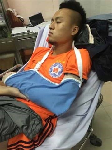 Vo Huy Toan phai phau thuat 2 lan, nghi thi dau 6 thang hinh anh 1