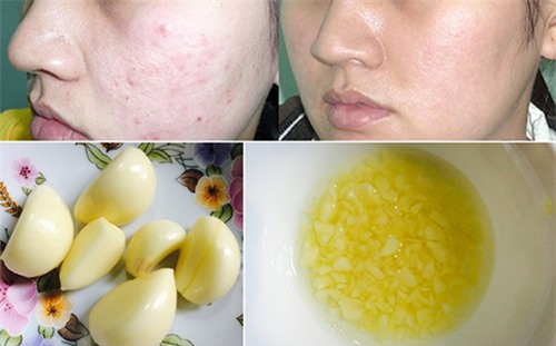 am anh "da mun" se khong con chi voi nguyen lieu 2 ngan dong co san trong bep - 6