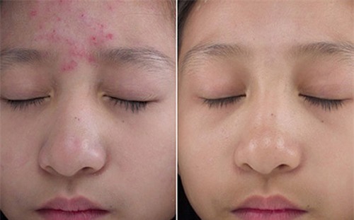 am anh "da mun" se khong con chi voi nguyen lieu 2 ngan dong co san trong bep - 7