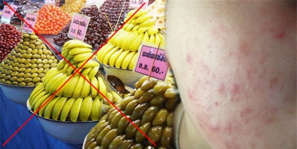 thực phẩm gây mụn 0