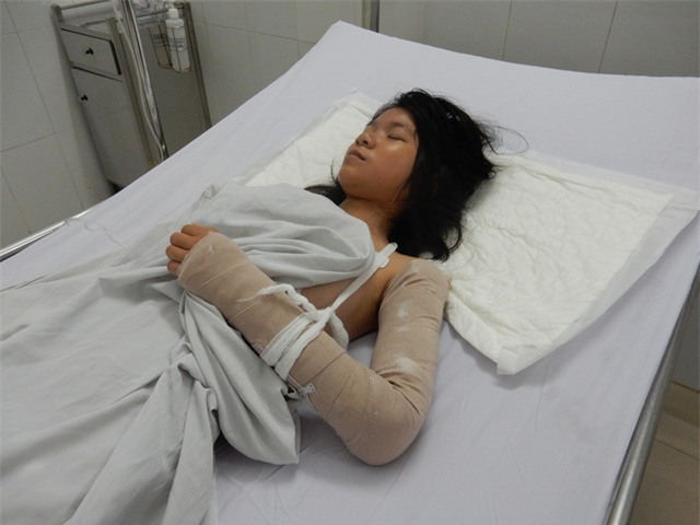 Cháu Linh bị gãy cánh tay trái, chấn thương lách độ 3, chấn thương thận độ 3 – 4